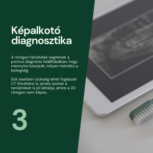 Fogászati góckutatás menete - képalkotó diagnosztika - HerbaDENT