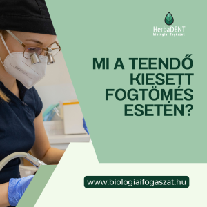 Mi a teendő kiesett fogtömés esetén? - HerbaDENT