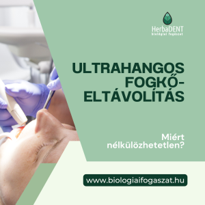 ultrahangos fogkőeltávolítás