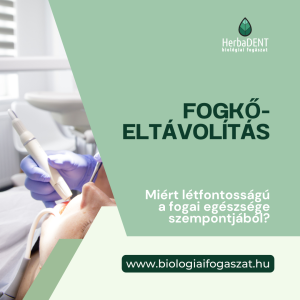 fogkőeltávolítás