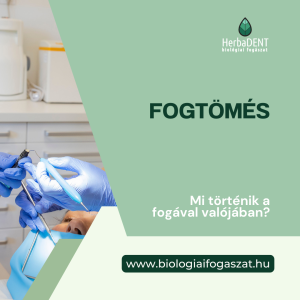 fogtömés