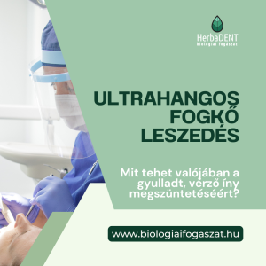 ultrahangos fogkő leszedés