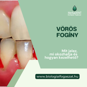 Vörös fogíny