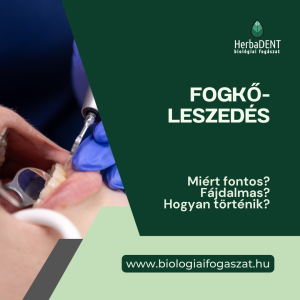 fogkőleszedés