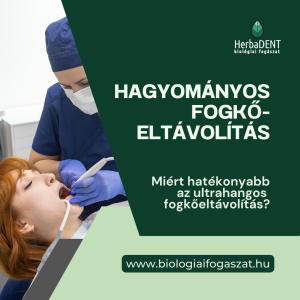 Hagyományos fogkőeltávolítás