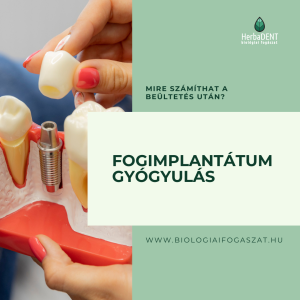 Fogimplantátum gyógyulás
