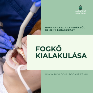 Fogkő kialakulása