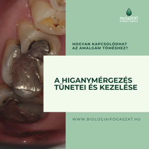 Higanymérgezés